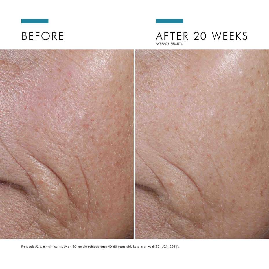 CE Ferulic met 15% L-ascorbinezuur