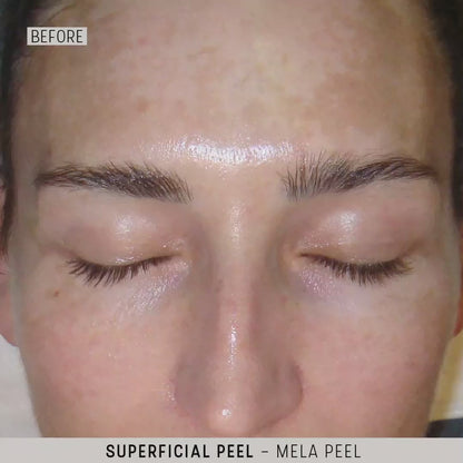 Mela cream